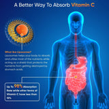 ليبوزومال فيتامين سي 1000 ملج 250 مل - Weight World Liposomal Vitamin C 1000 mg 250 ml