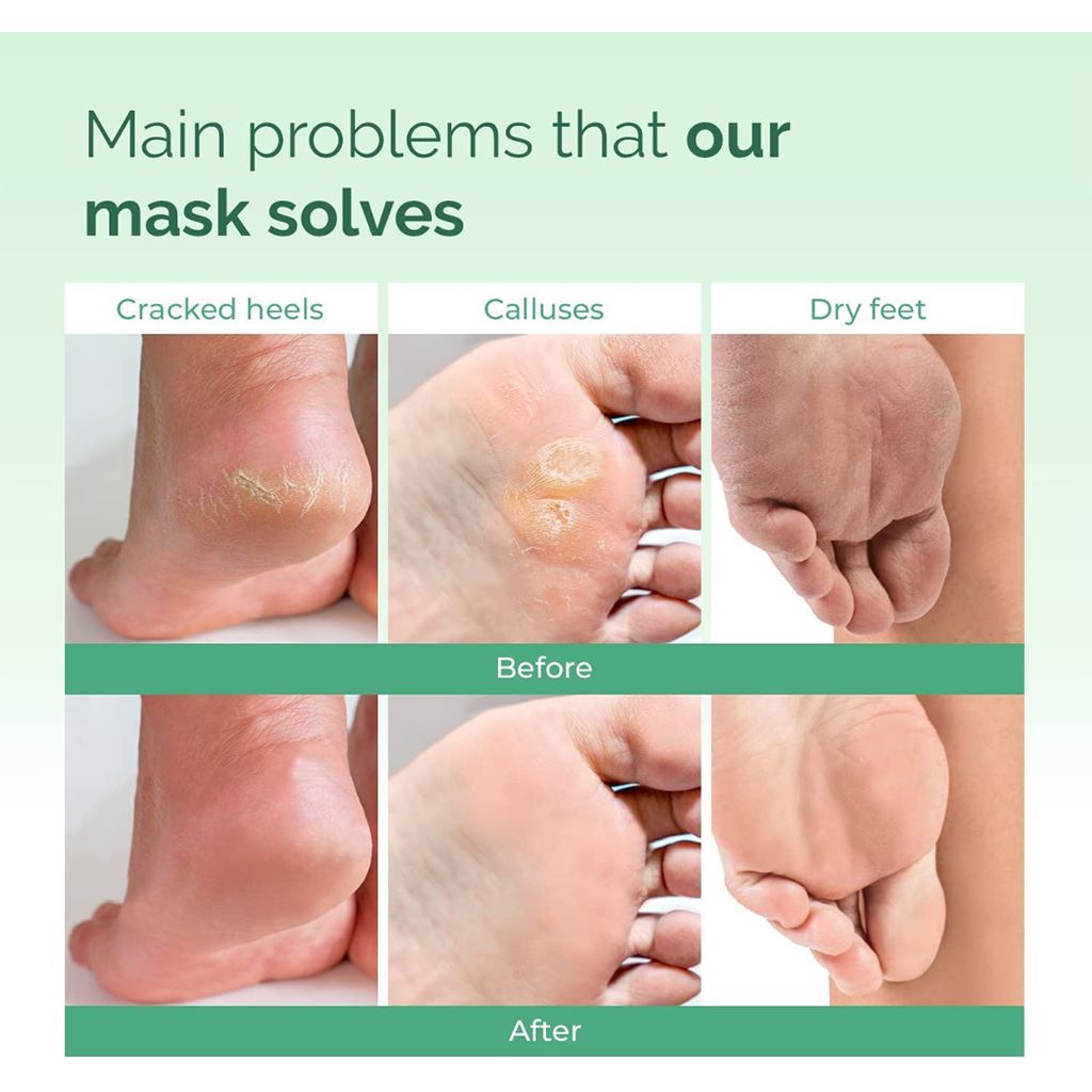 Plantifique Foot Peel Mask 2 Pairs 